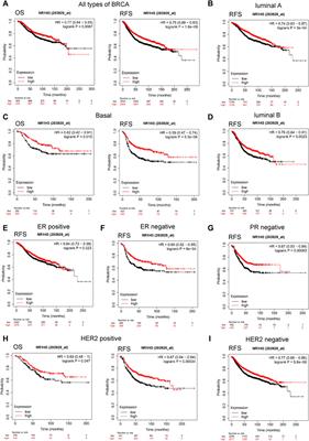 Low expression of NR1H3 correlates with macrophage infiltration and indicates worse survival in breast cancer